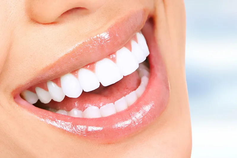 How to Find Affordable General Dentistry Services in VA