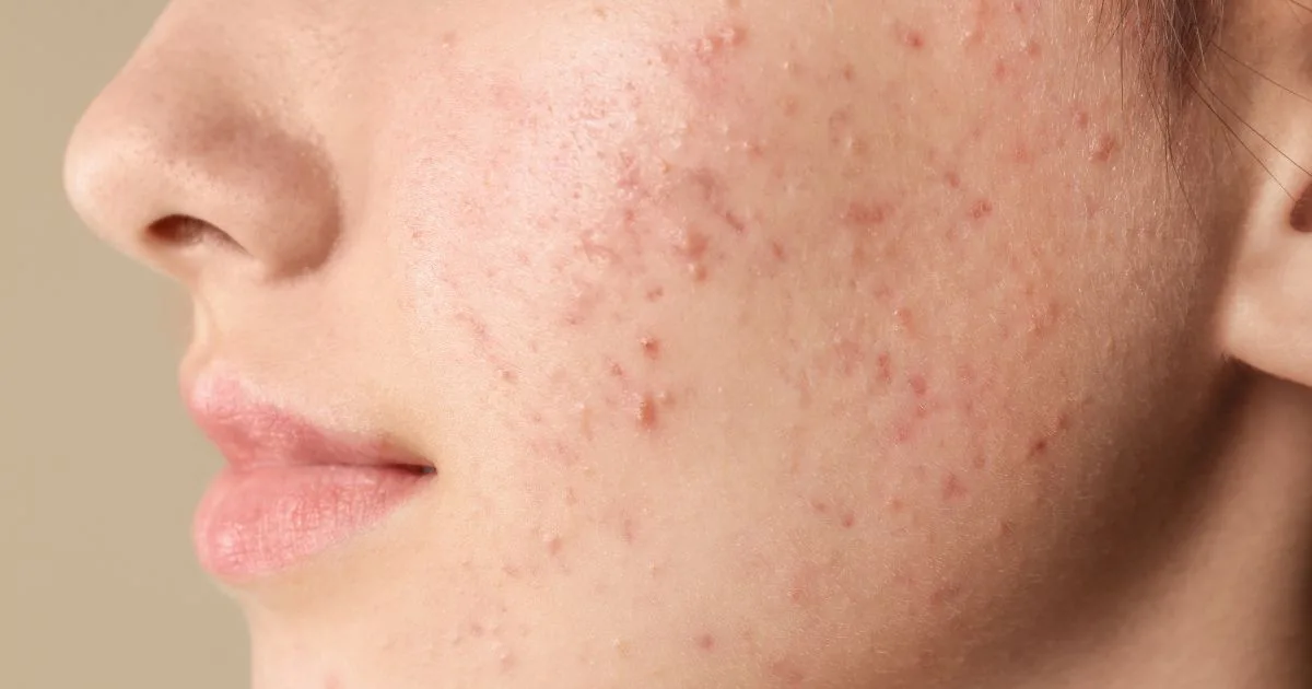 Skin Infection, Skin Treatment, and Skin Rash: Symptoms, Causes, Diagnosis, and Effective Care