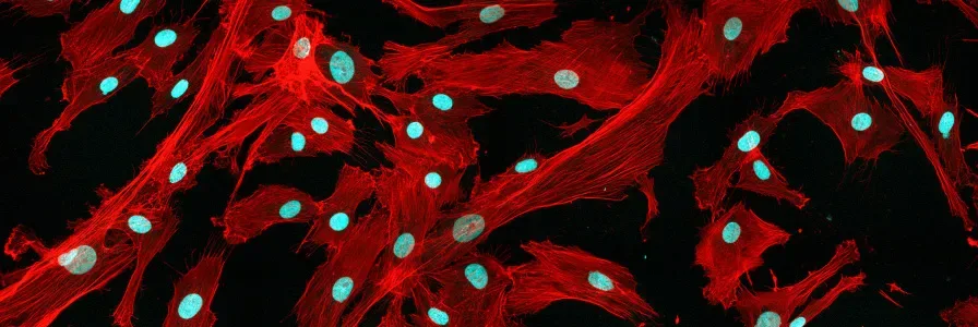 How Mesenchymal Stem Cells Work and What a Treatment Visit Looks Like
