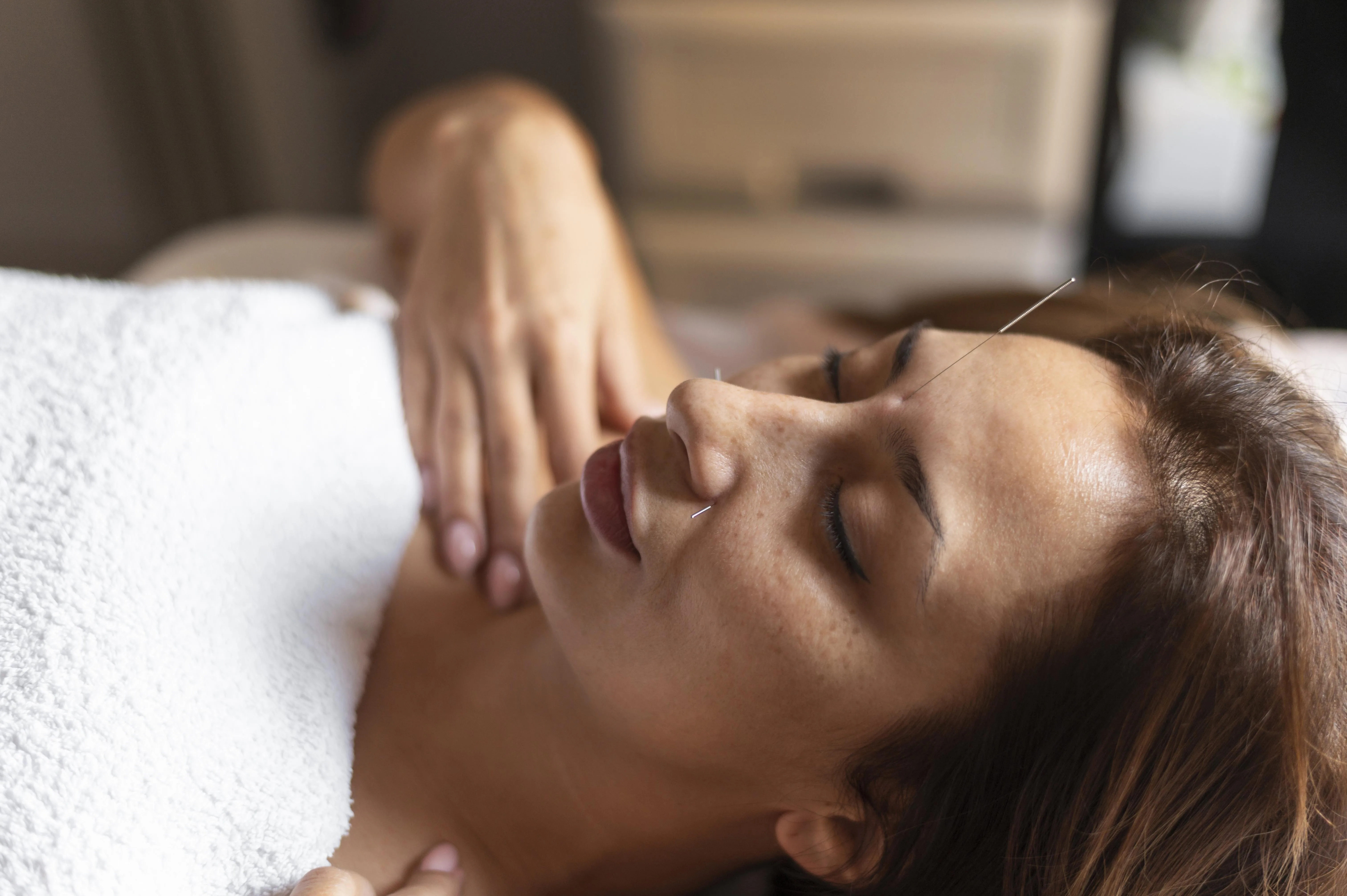 How Acupuncture Supports Mental Wellness in Frederick