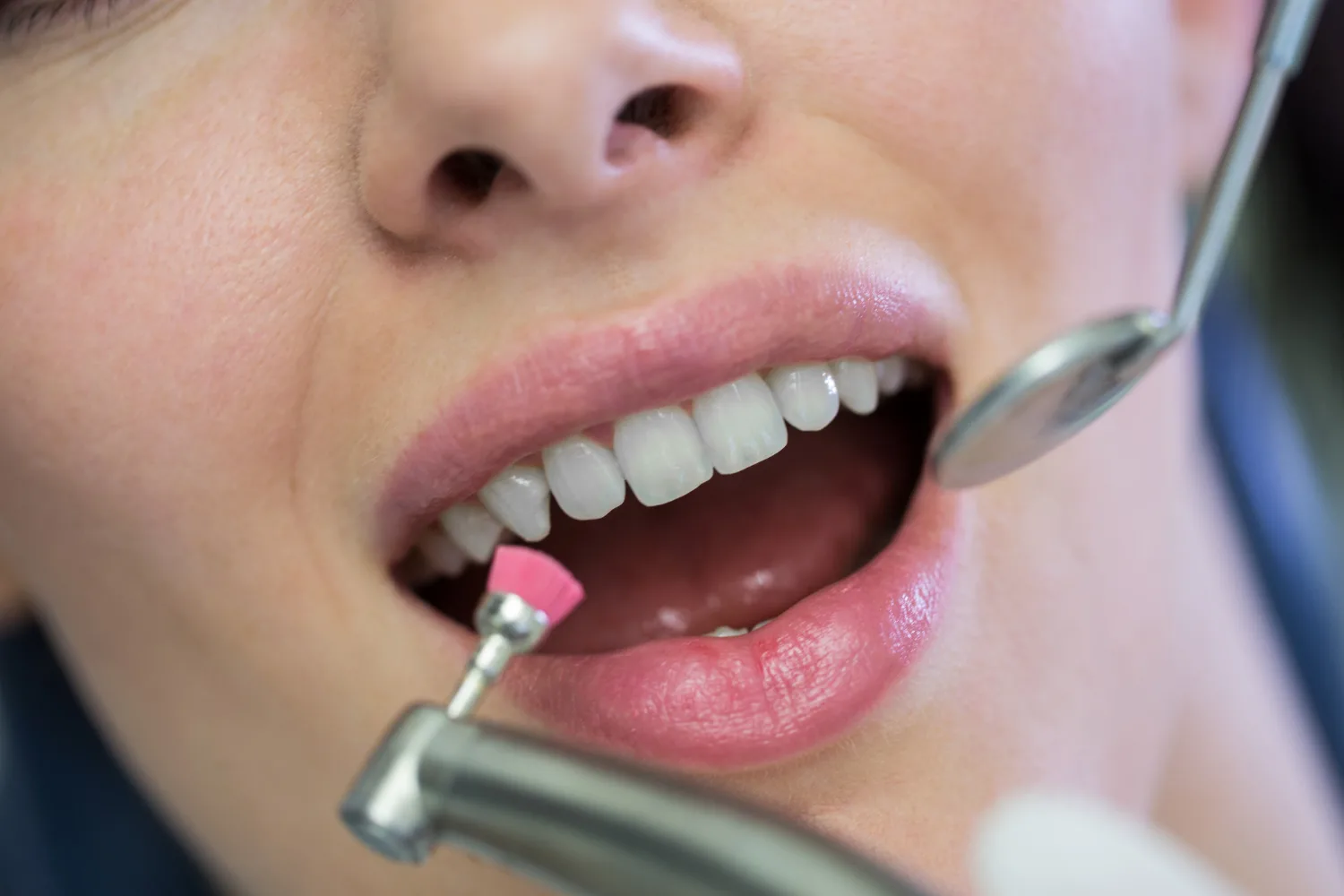 Best Dental Clinic in Rajarajeshwari Nagar for Modern Dental Treatments