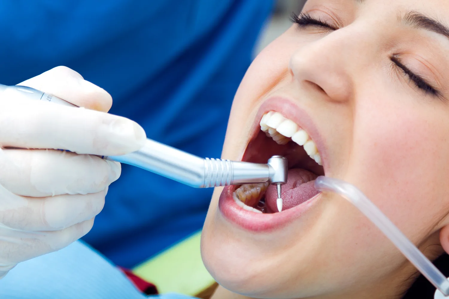 Signs You May Need a Root Canal Treatment in Hyderabad