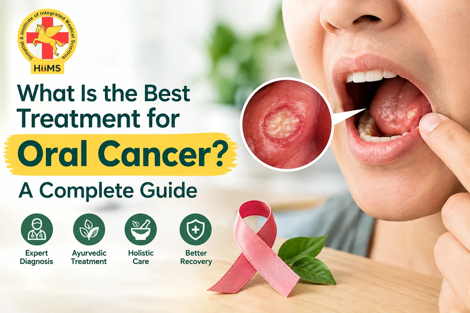 What Is the Best Treatment for Oral Cancer? A Complete Guide