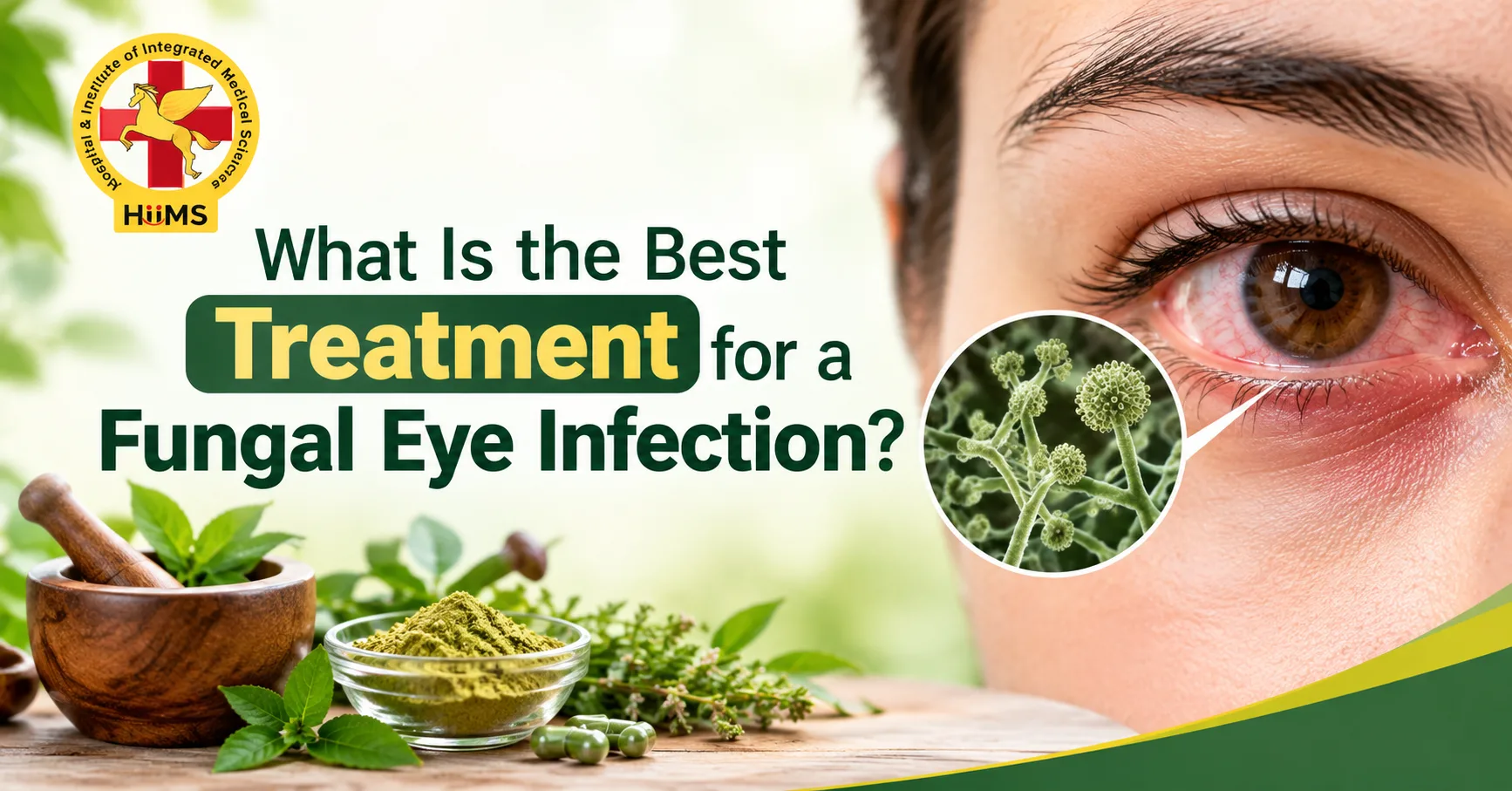What Is the Best Treatment for a Fungal Eye Infection?