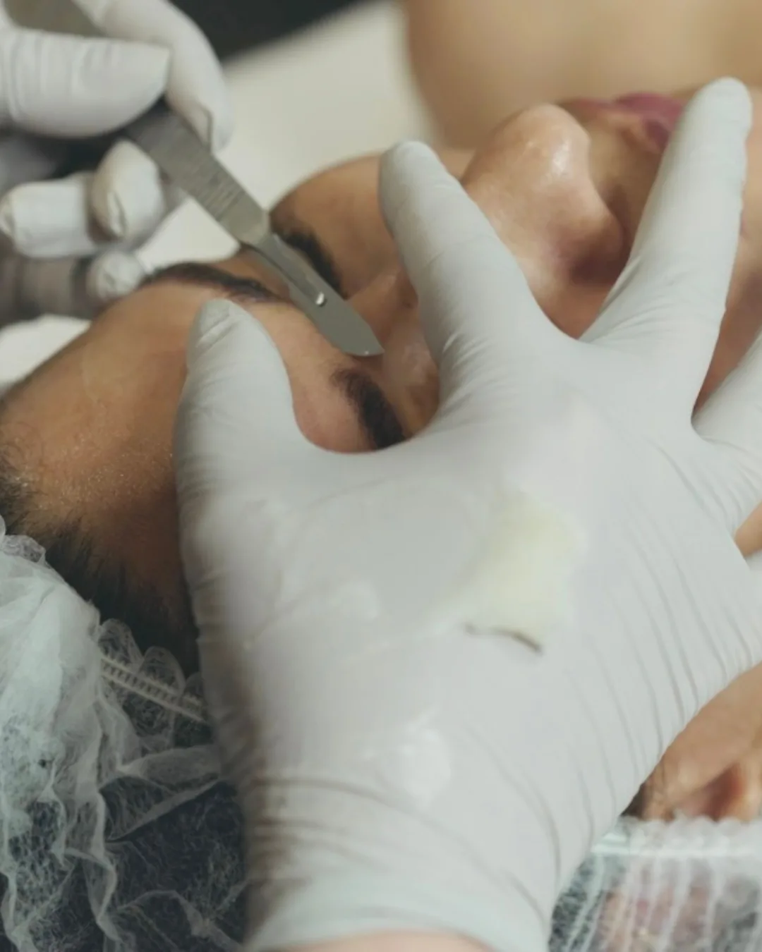How to Prepare Clients for a Professional Dermaplaning Treatment