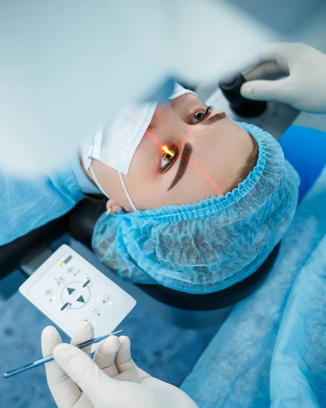 Redness in Eyes After Cataract Surgery – Causes, Recovery & Care