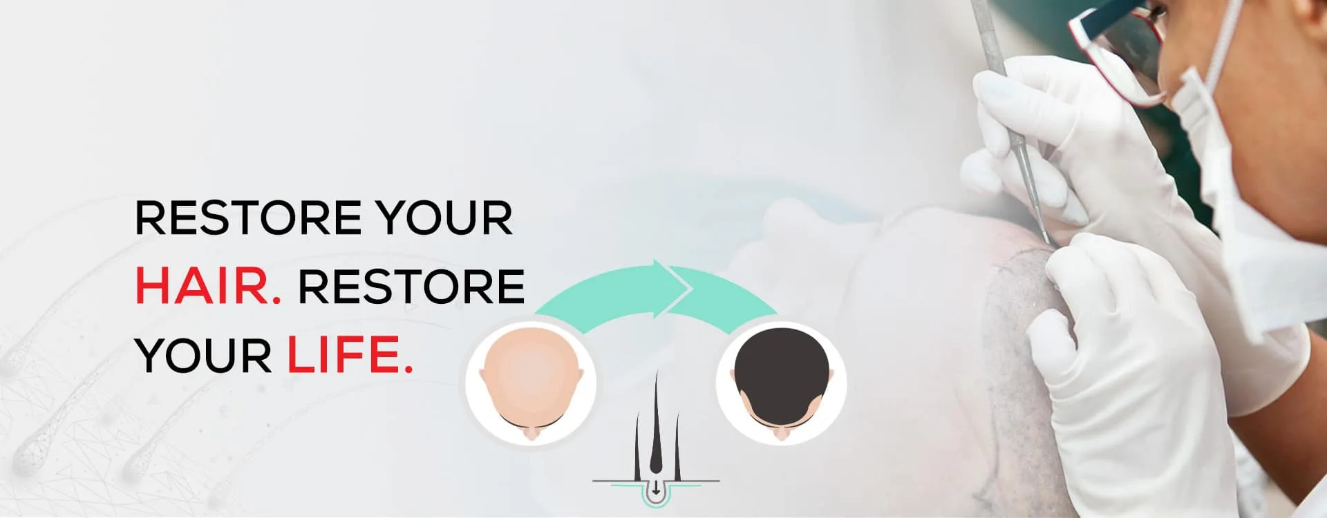 Best Guide to Choosing the Right Hair Clinic for Natural Hair Restoration in Ahmedabad