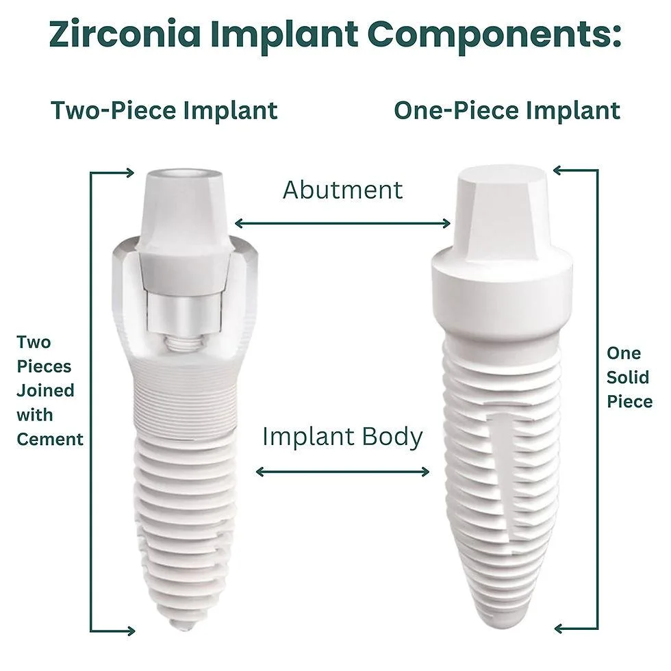 One-piece vs Two-piece Ceramic Dental Implants: Understanding the Key Differences