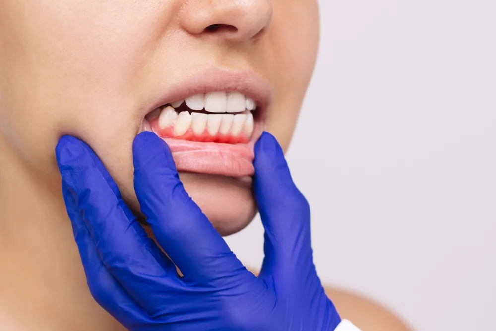Protecting Your Smile: Understanding Periodontal Health and Modern Gum Treatment