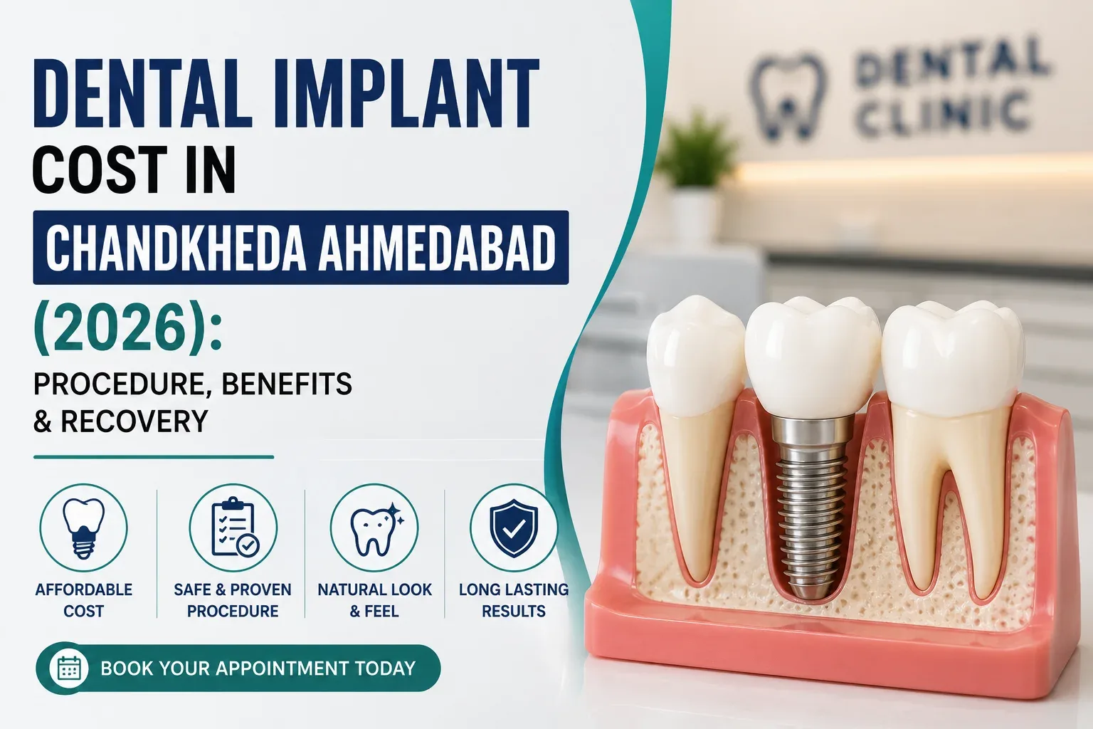 Dental Implant Cost in Chandkheda Ahmedabad (2026): Procedure, Benefits & Recovery