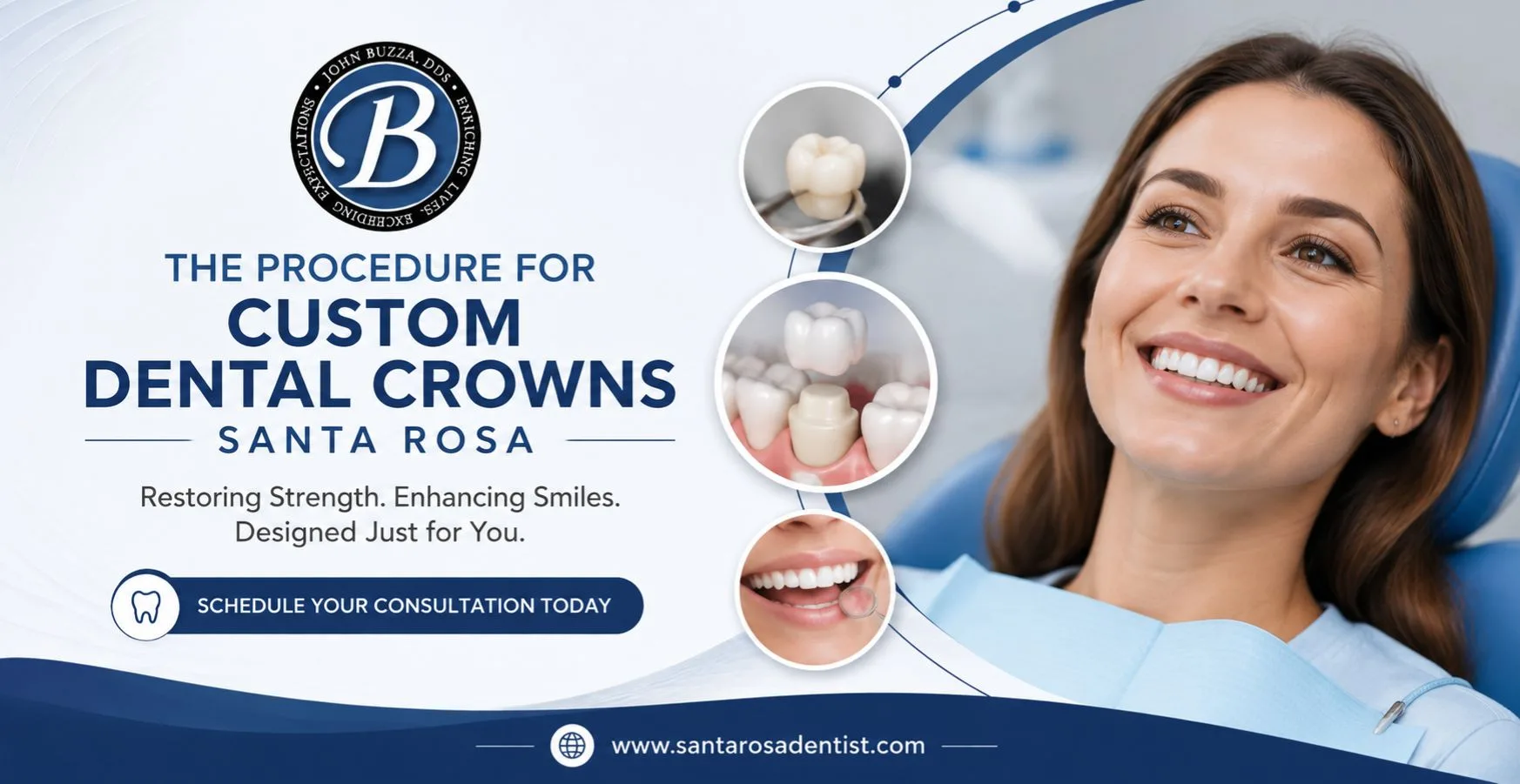 The Procedure for Custom Dental Crowns Santa Rosa