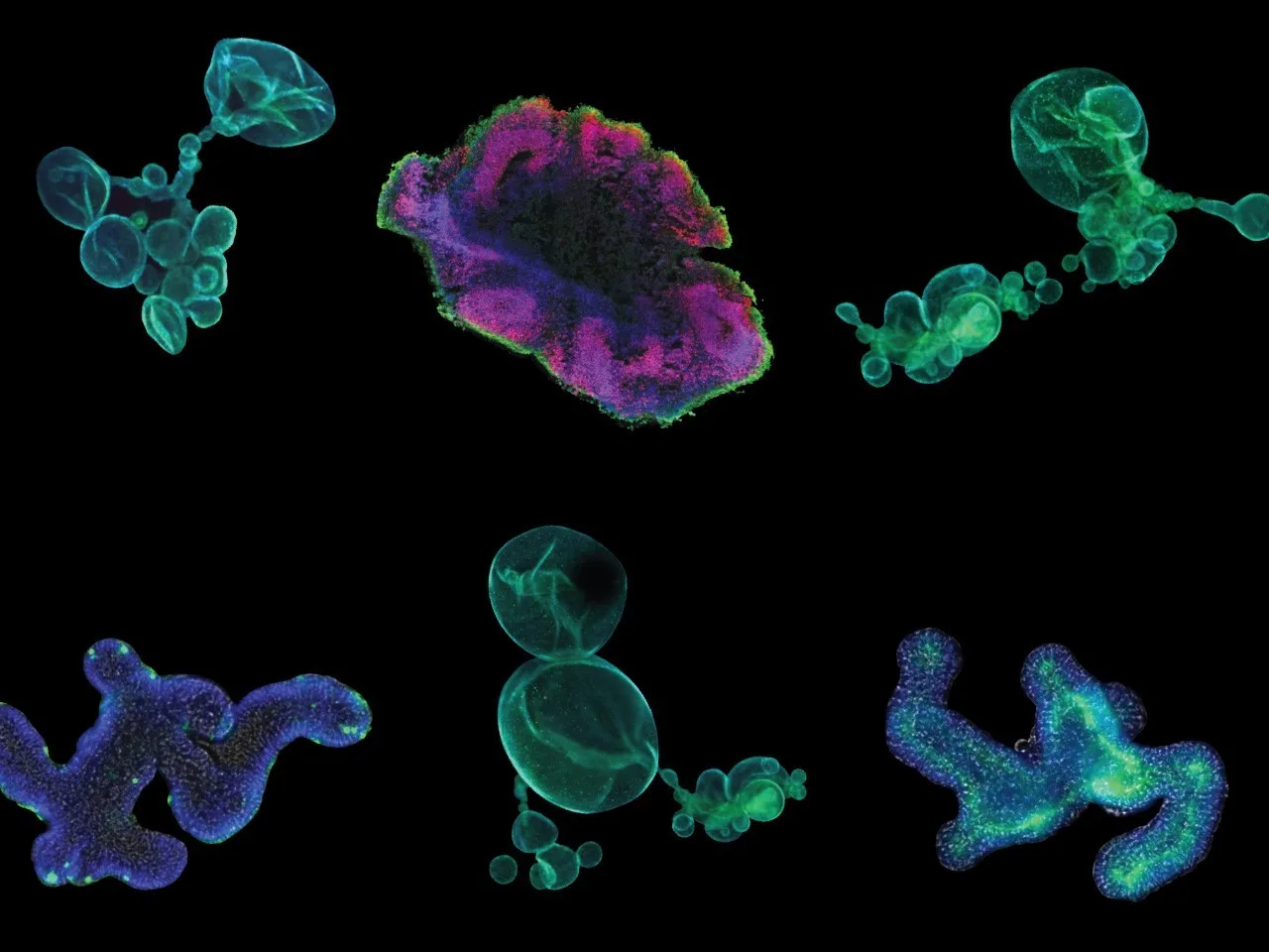 Organoids Market Pain Points Affecting Research, Scalability, and Commercial Adoption