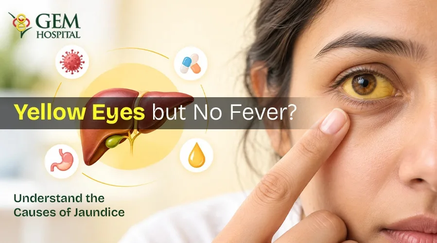 Yellow Eyes Without Fever: Hidden Health Reasons You Should Not Ignore