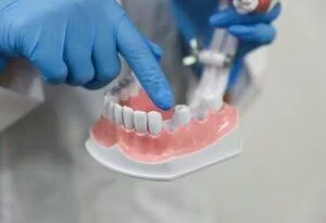 Dental Implants in Weybridge | Munro Hall Clinic