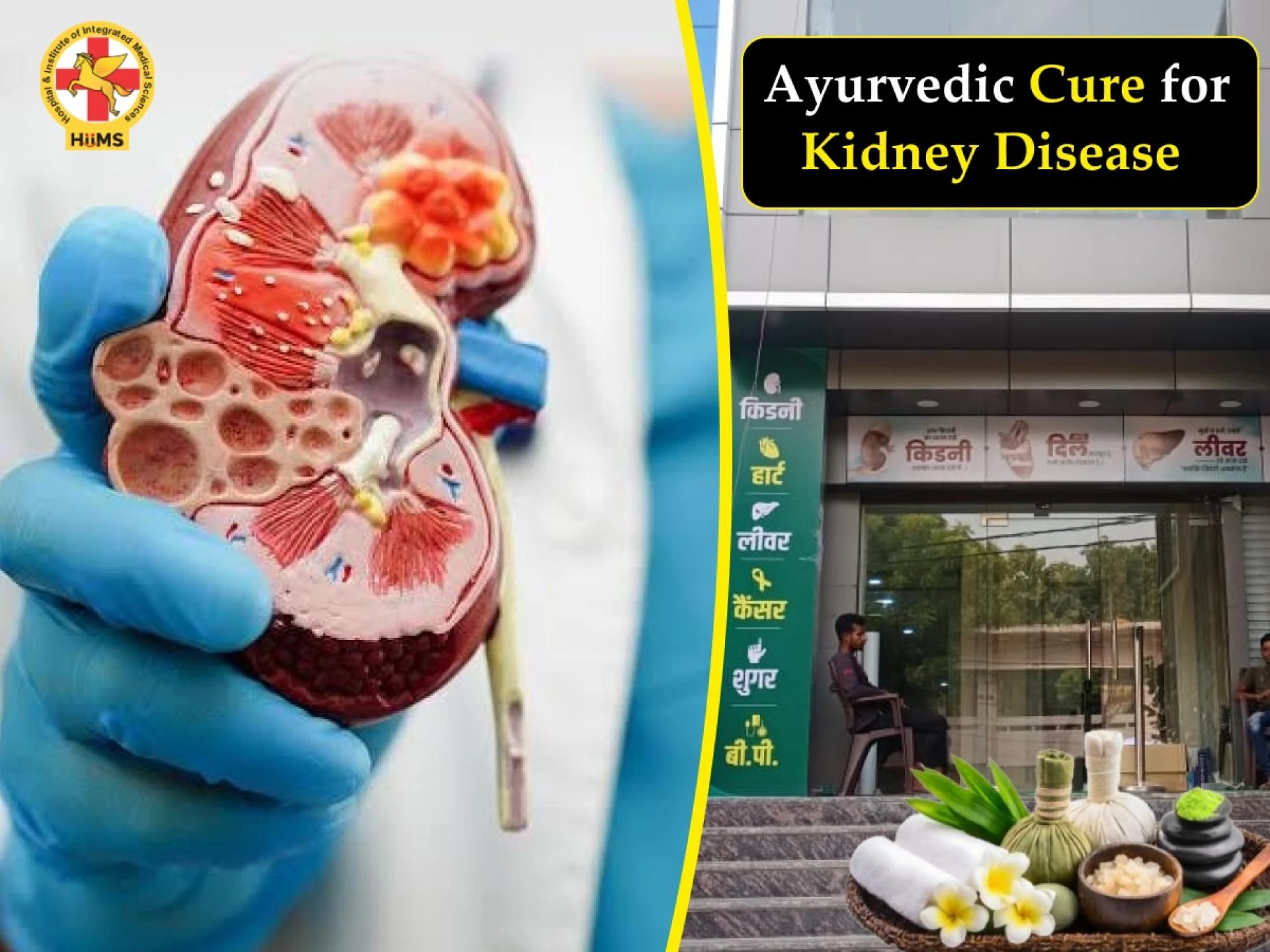 Ayurvedic Cure for Kidney Disease: Myths & Facts  