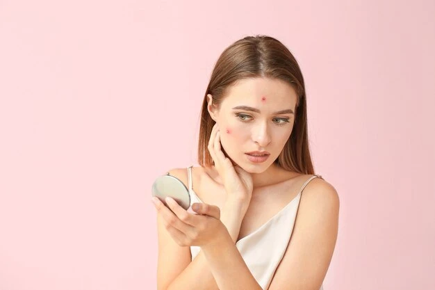 What Makes Acne Treatment Popular?