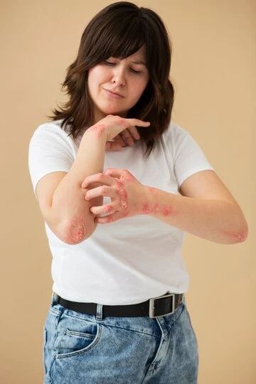 How To Manage And Calm Skin Allergies?