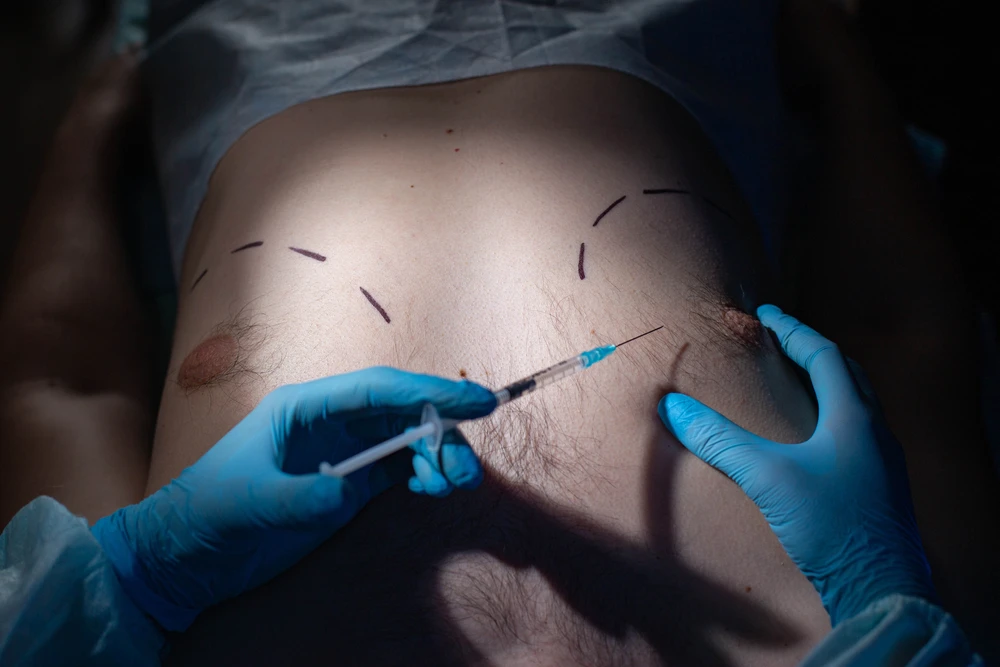 Redefining Beauty and Confidence: Plastic Surgery in Ghana 