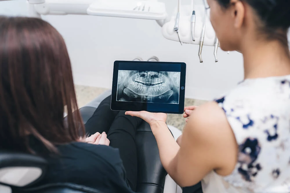 Transform Your Smile with Composite Veneers in Brisbane: A Cost-Effective Cosmetic Solution