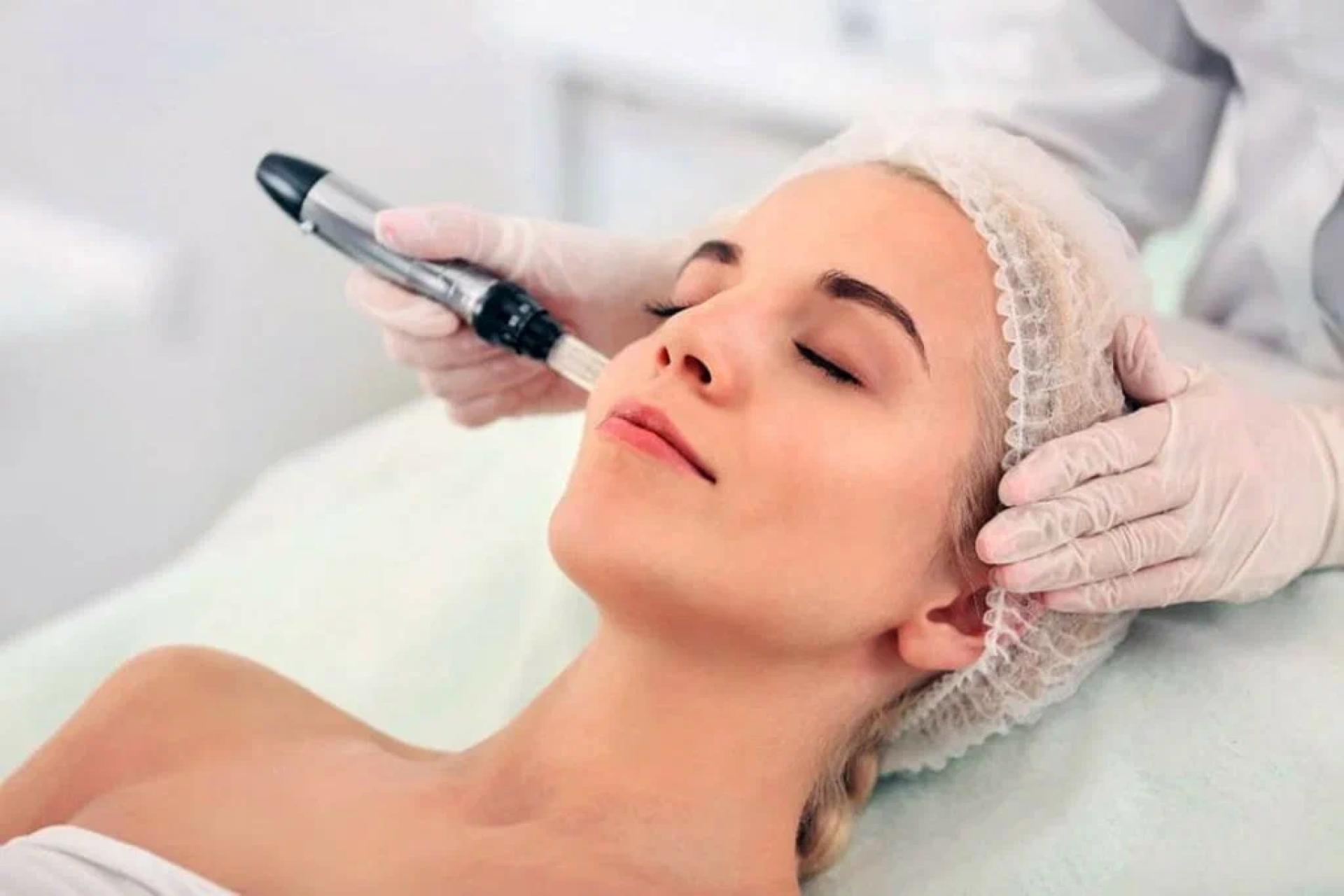 Microneedling: The Secret to Radiant, Youthful Skin