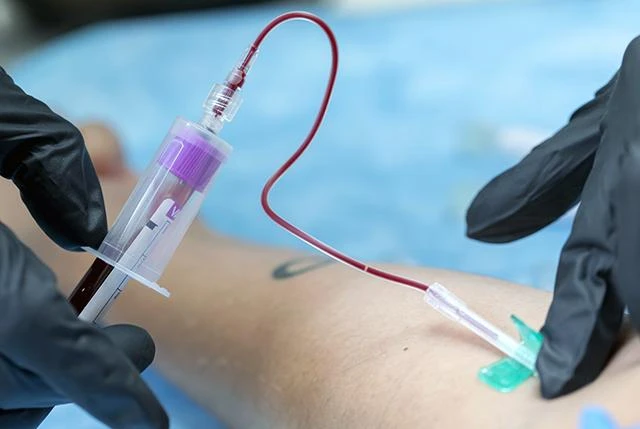 Common Health Issues Detected Early Through Routine Blood Tests in Hyderabad