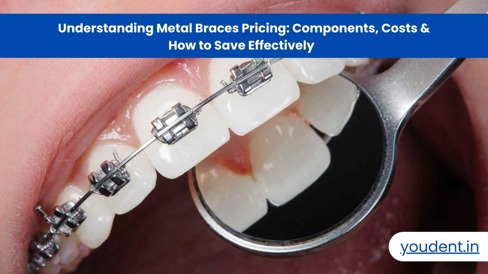 Draft: My PUnderstanding Metal Braces Pricing: Components, Costs & How to Save Effectively  ost Title
