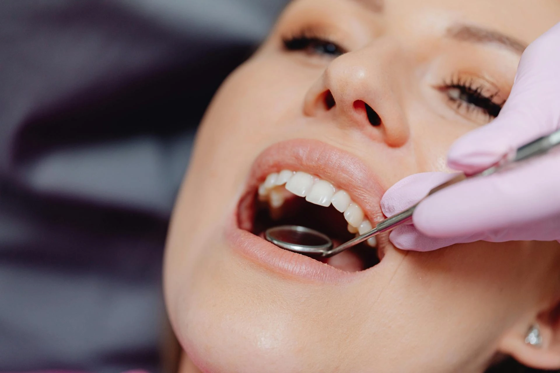 Why Brisbane Dentists Prefer Implants Over Traditional Dentures