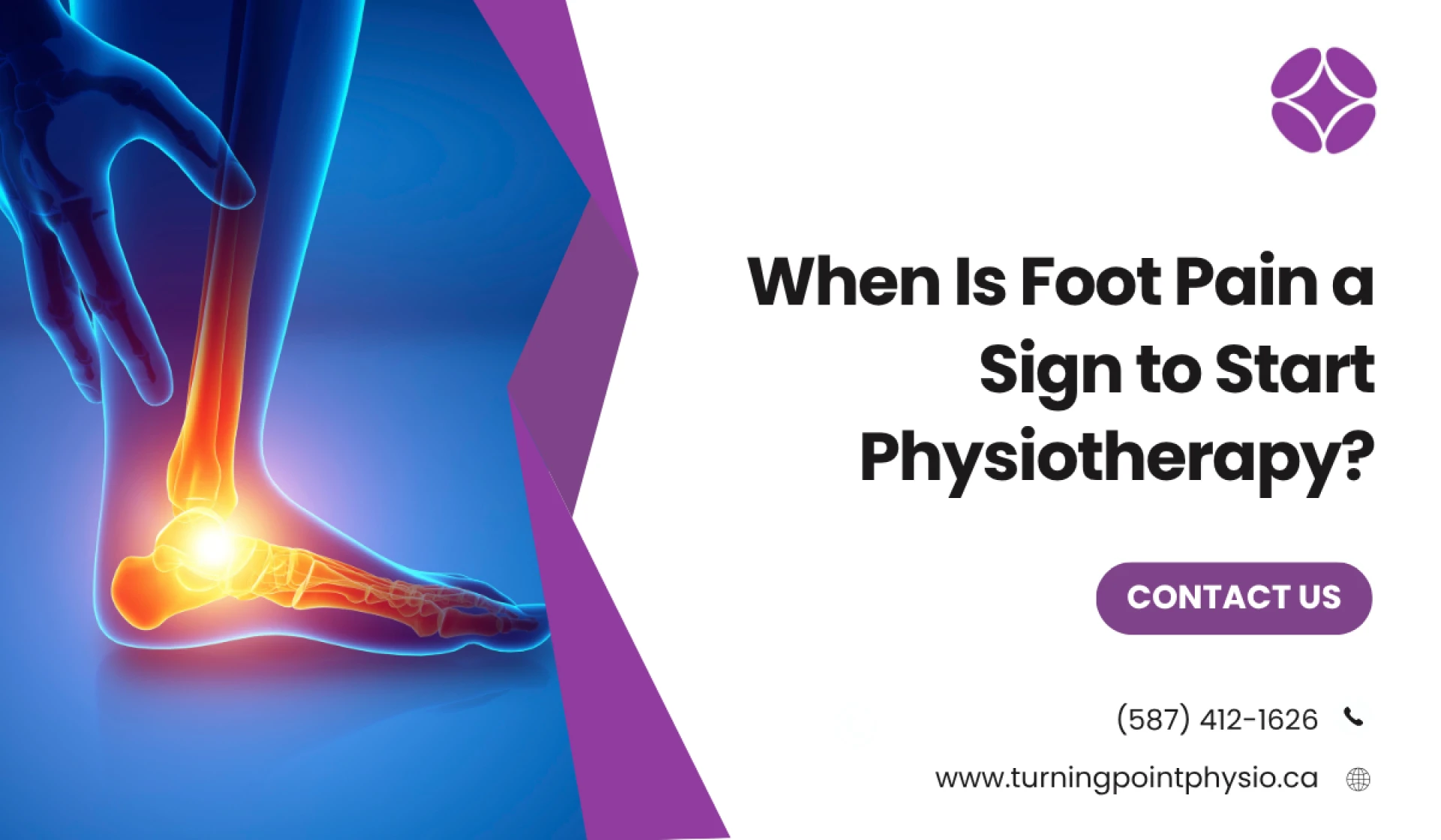 When Is Foot Pain a Sign to Start Physiotherapy?