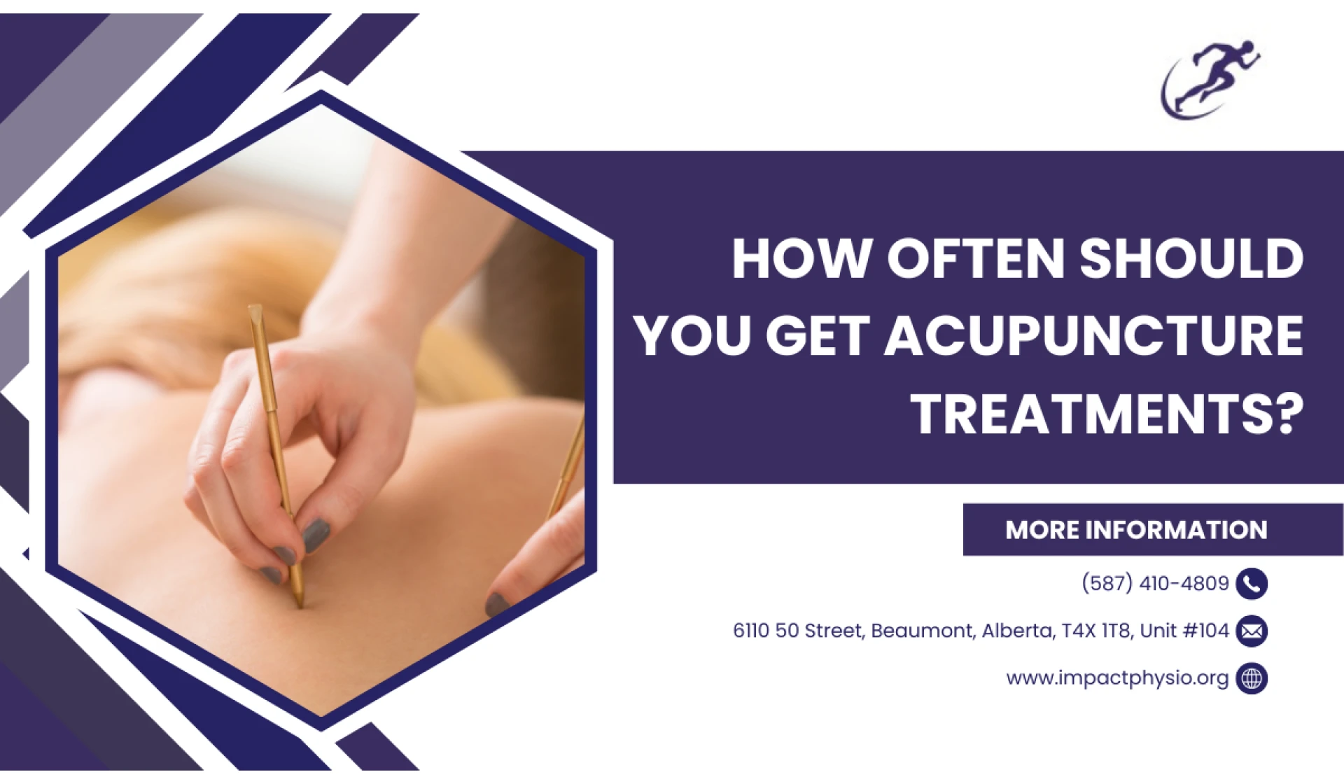 How Often Should You Get Acupuncture Treatments?