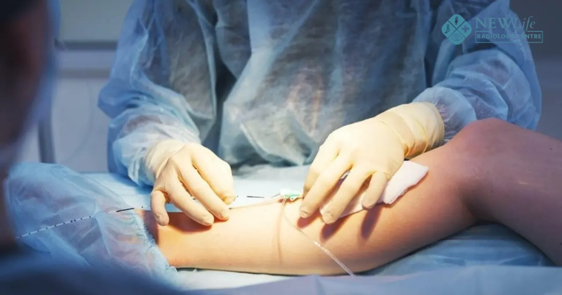 Understanding Vascular Procedures in Thane: A Simple Guide for Better Health By New Life Radiology Clinic