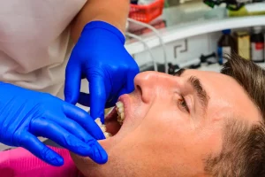 Transform Your Smile with Veneers in Brisbane