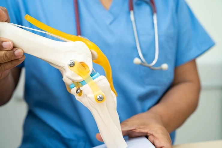 Your Knee Surgery Questions - Answered