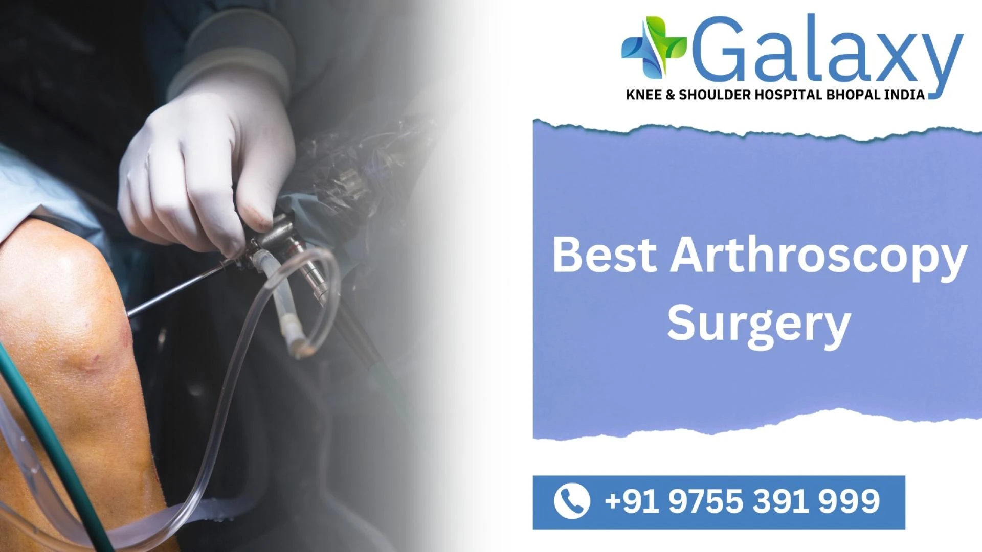 Best Arthroscopy Surgery in Bhopal   +91-9755391999