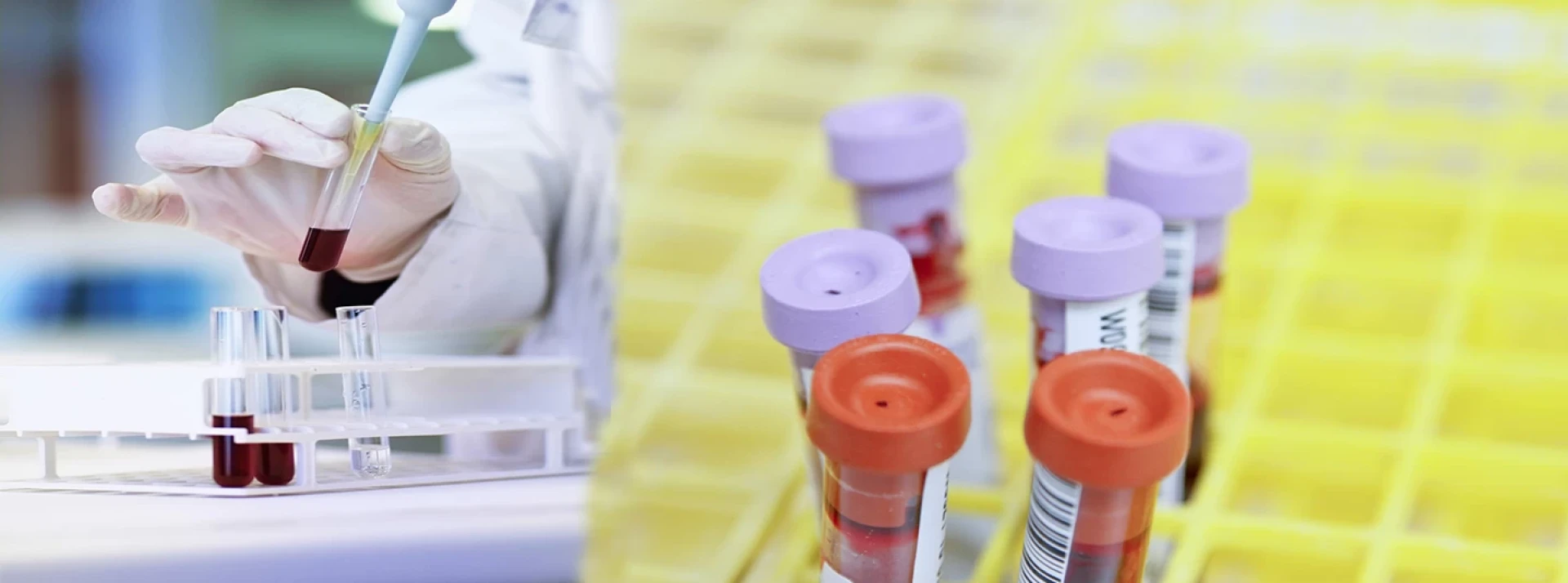 Kidney Tests in Monsoon: Why LFT & RFT Matter More Than Ever