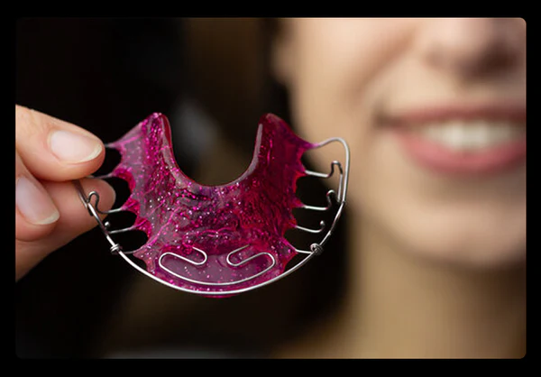 The Complete Guide to Retainers: Types, Benefits, and Why You Should Never Skip Them