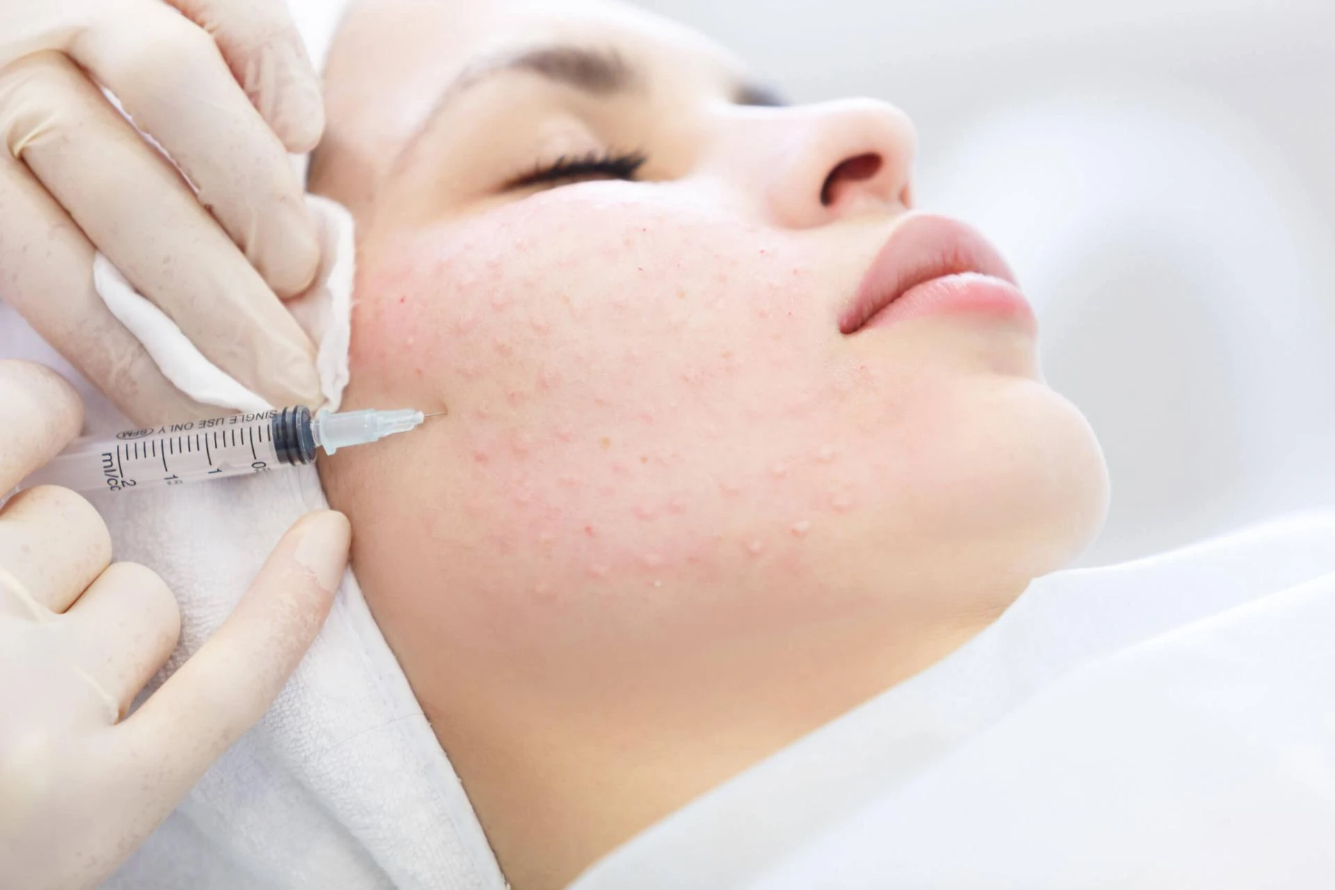 How Skin Booster Injection Helps With Wrinkles?