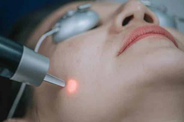 Laser Hair Removal vs Traditional Methods: Pros and Cons