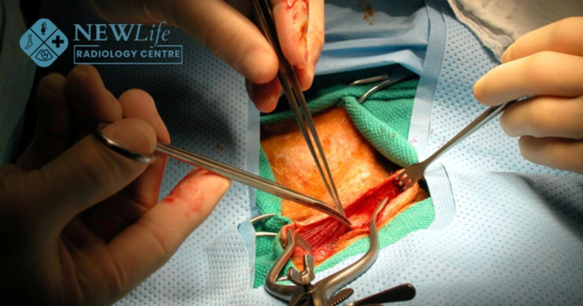 From Diagnosis to Recovery: How Vascular Procedures in Thane Are Changing Healthcare