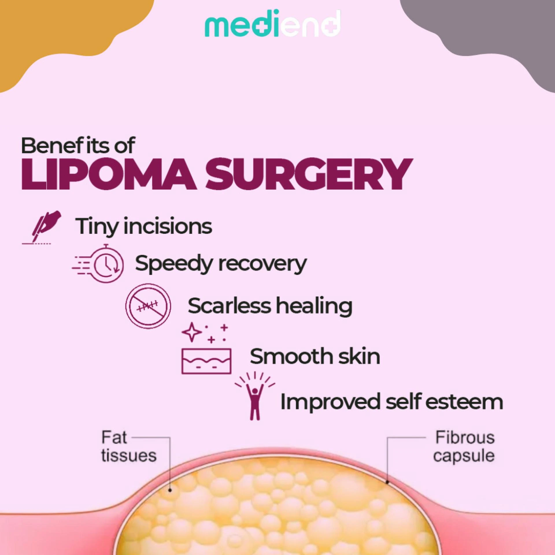 Difference between lipoma and other skin lumps