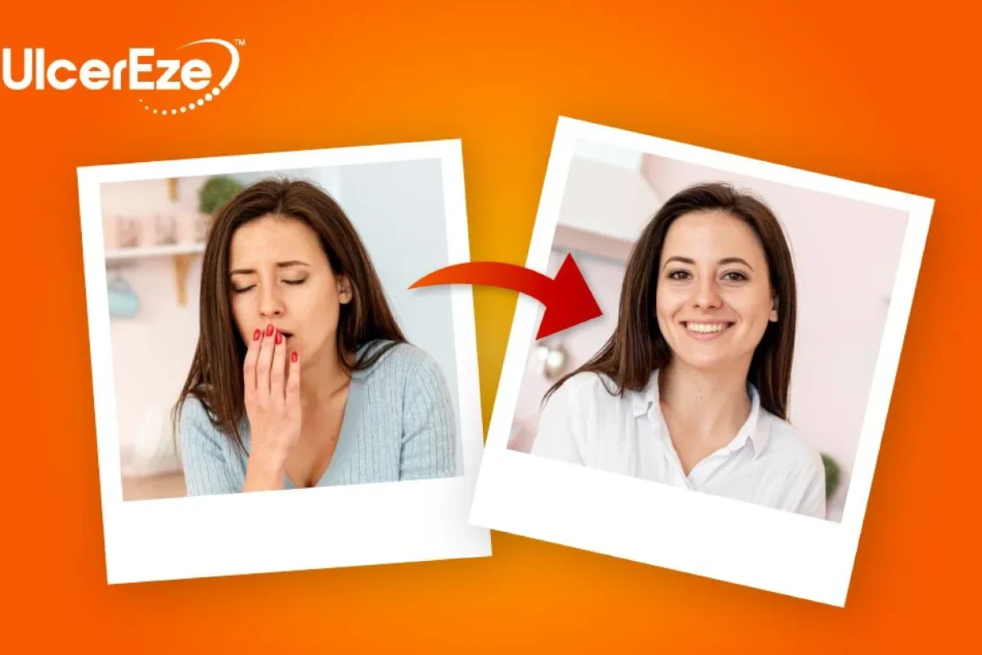 How to Get Rid of Mouth Ulcers: A Fast, Practical Guide