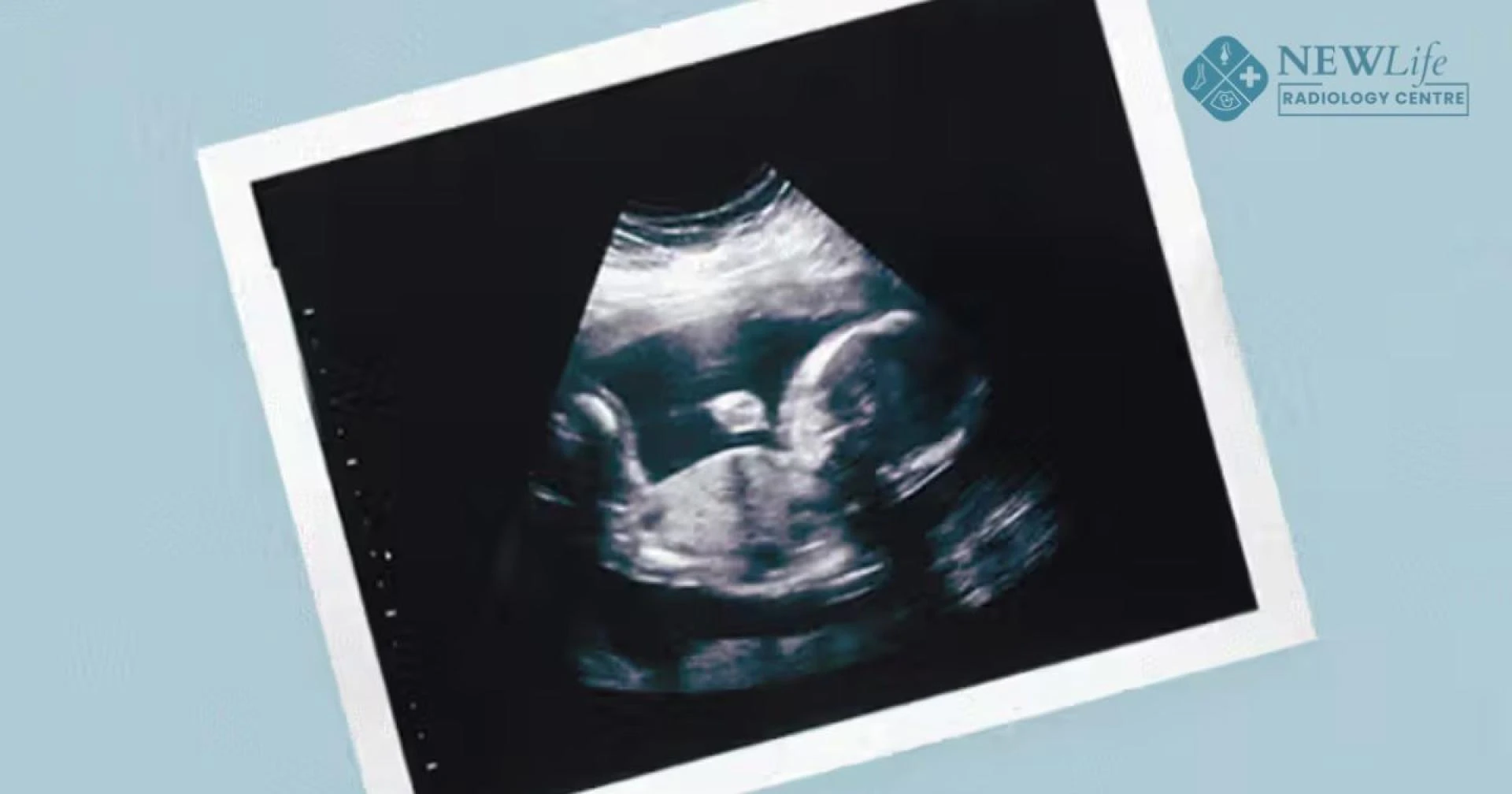 Antenatal Care Ultrasound in Thane Did You Know ANC Scan During Pregnancy Can Reveal 3 Surprising Insights