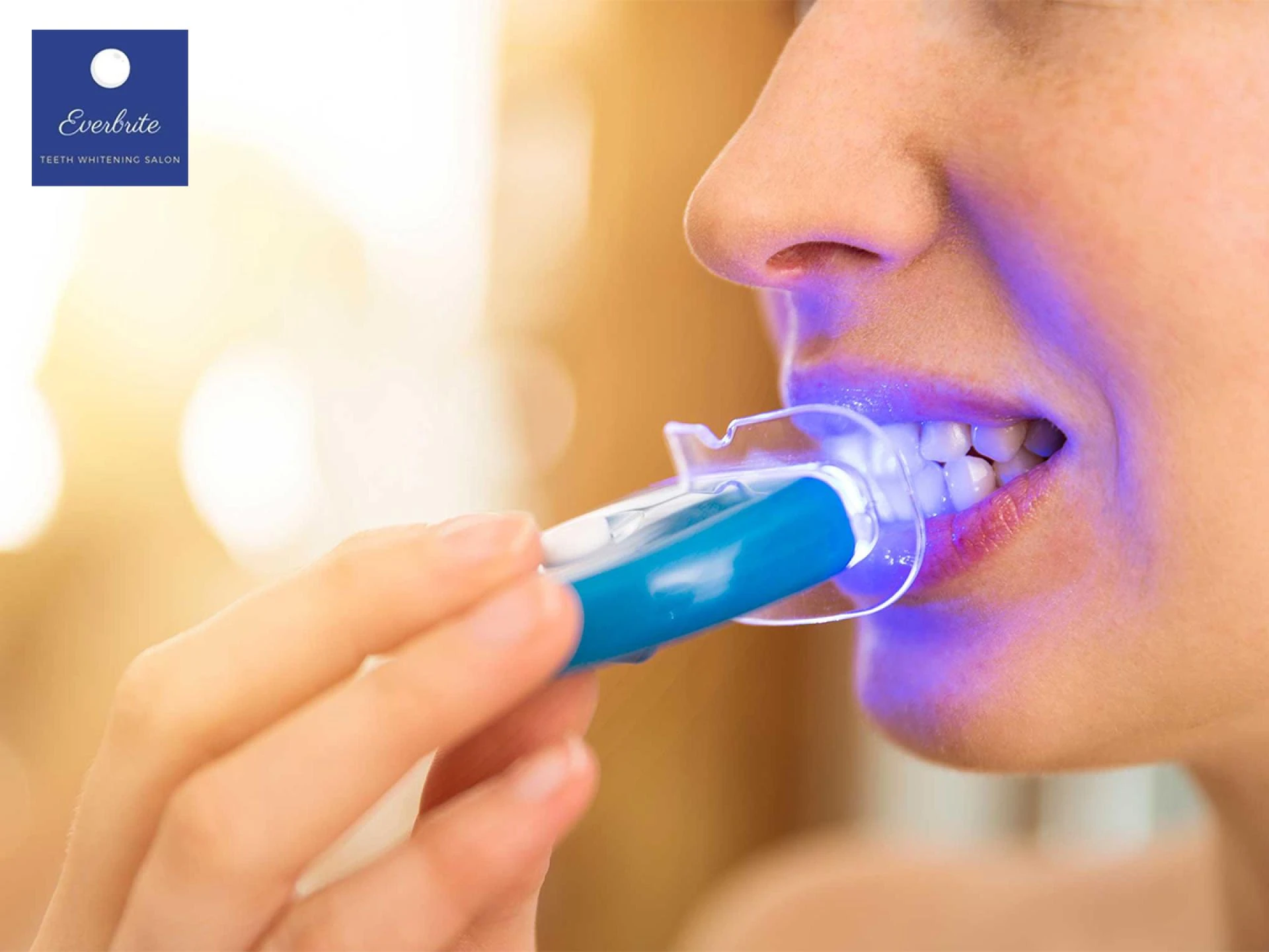 Unhiding the Unfiltered Truth About the Best Professional Teeth Whitening