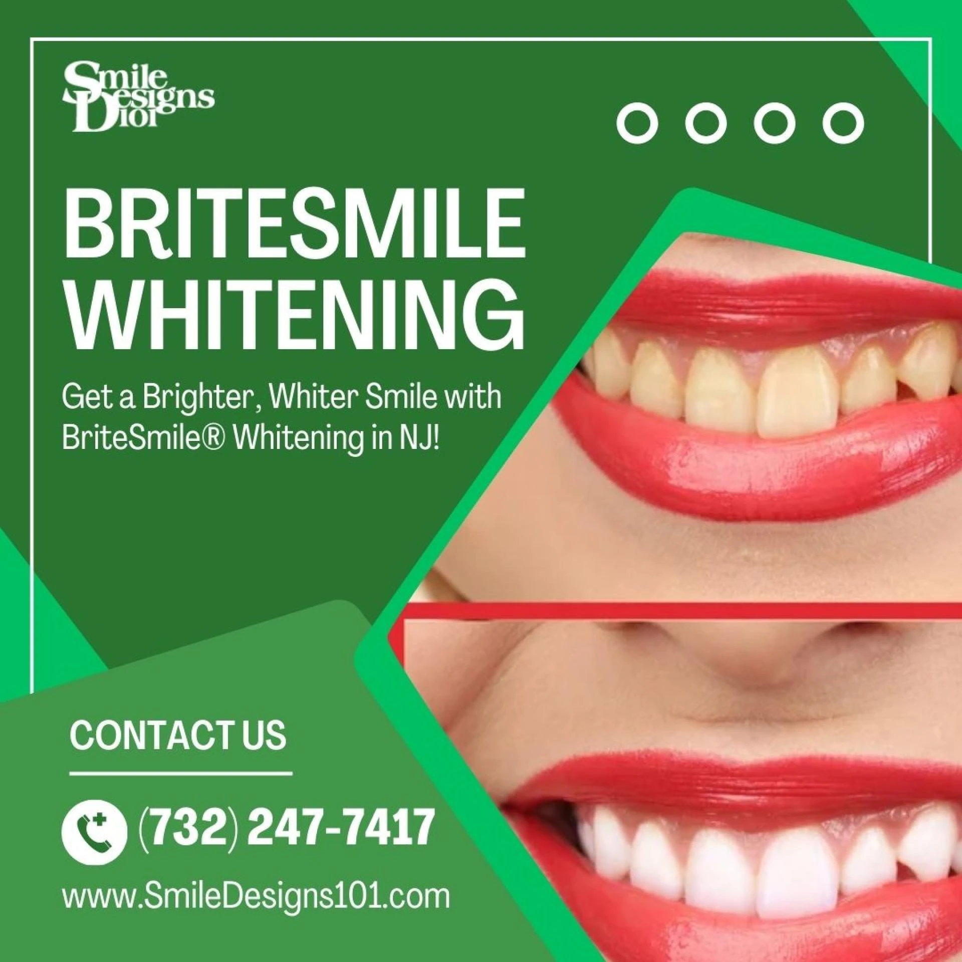 Can BriteSmile Teeth Whitening Remove Coffee and Wine Stains in Somerset, NJ?