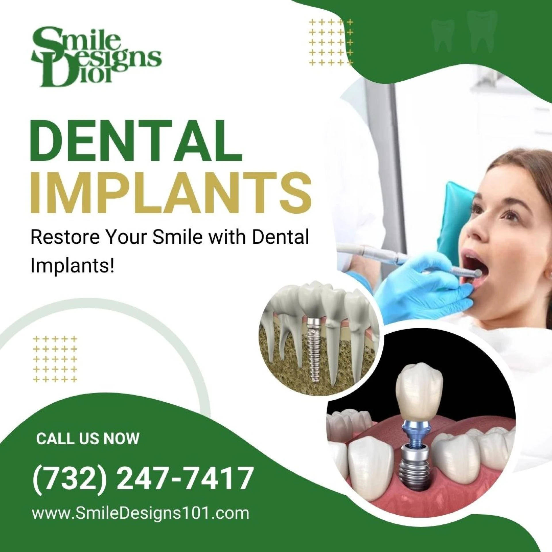 How Far Is the Nearest Dental Implant Center from Downtown Somerset, NJ?