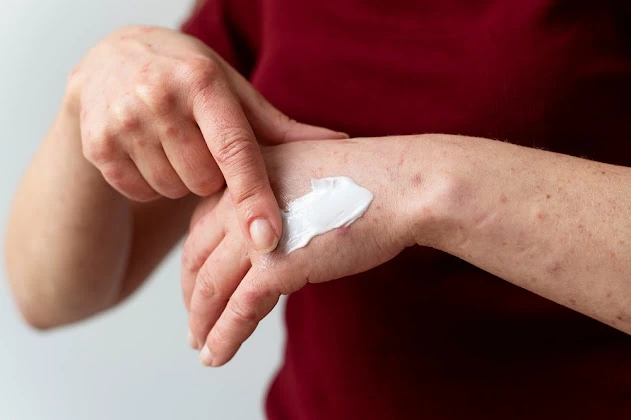 Future of Wound Healing: Emerging Trends in the Wound Biologics Market