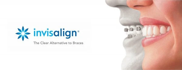 Your First Week with Invisalign in West Hollywood: What to Expect & Do