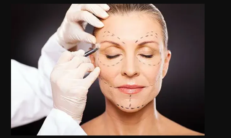Exploring Plastic Surgery in Chicago: What You Need to Know