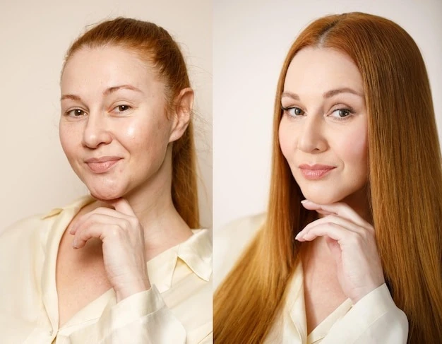 Why South Korea Leads the World in Aesthetic Medicine