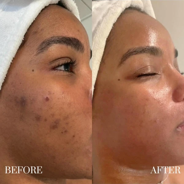 Skin Confidence in the Triangle: How a Raleigh Medspa Approach Elevates Everyday Care