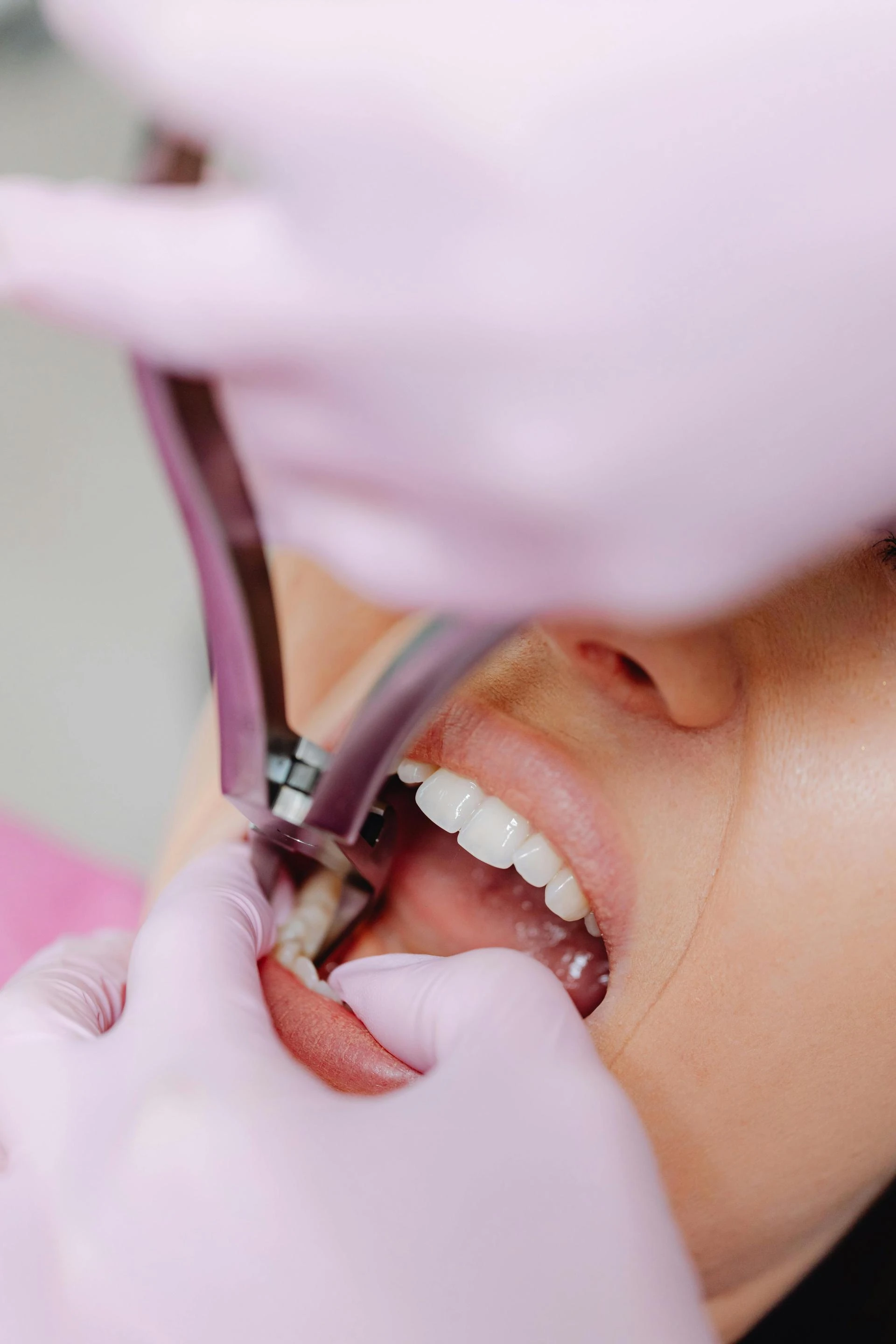 Why Choosing the Best Dentist Can Transform Your Oral Health